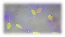 spermatozoidi